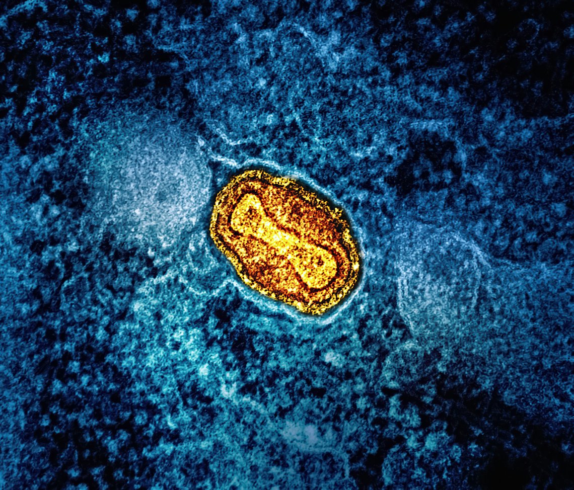 nationalinstituteofallergyandinfectiousdiseasescTqjQnqXnY8unsplash