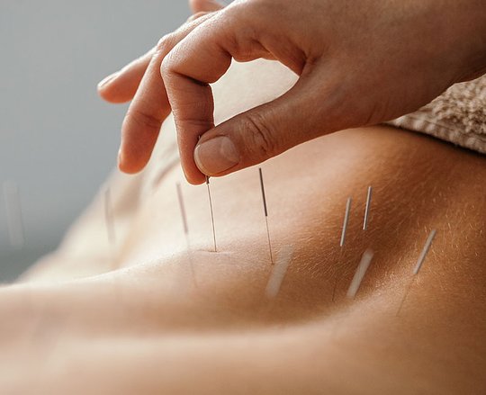 Acupuncturist